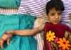 दो बच्चों की हाथ से टूटी कलाई को फिर से जोड़ने का करिश्मा